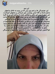 ووضعت الطبيبة ”عباسلو“ صورة من وضعها على صفحتها الشخصية على إنستغرام.