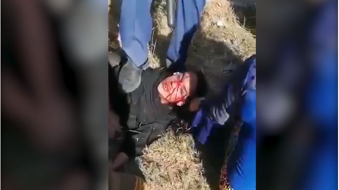 أثار نشر مقطع فيديو لفتاة مصابة في آبادان ووجهها مغطى بالدم يتم تعاملها بطريقة غير إنسانية من قبل حراس أمن متوحشين
