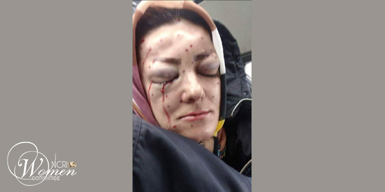 فقدت فريدة صلواتي بور من أهالي سنندج عينيها إثر إصابتها بـ بندقية ذات رصاصات كروية